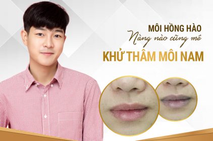 Khử thâm môi nam tự nhiên, an toàn ở đâu tại Biên Hòa